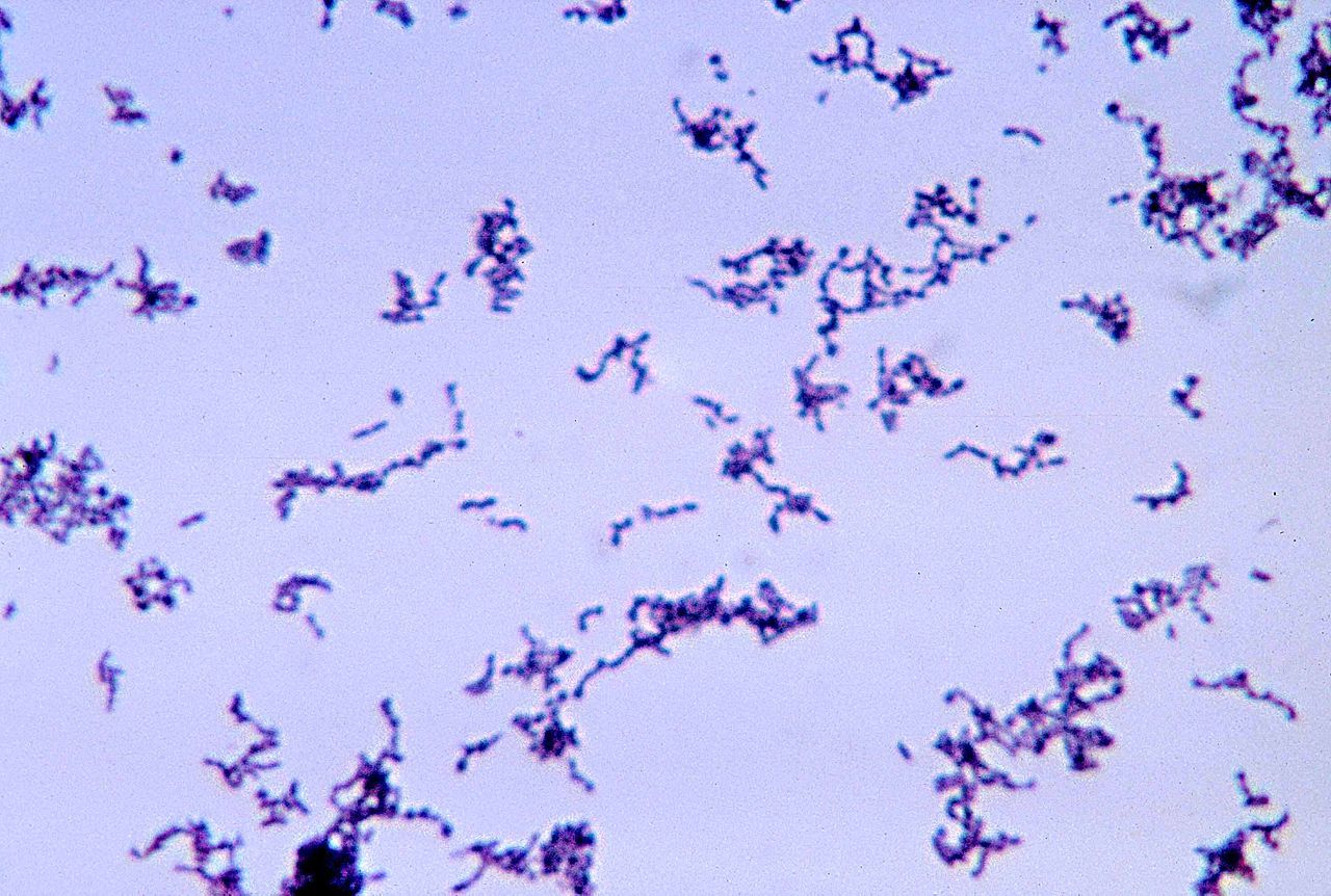 Quelles sont les causes de l'acné ?