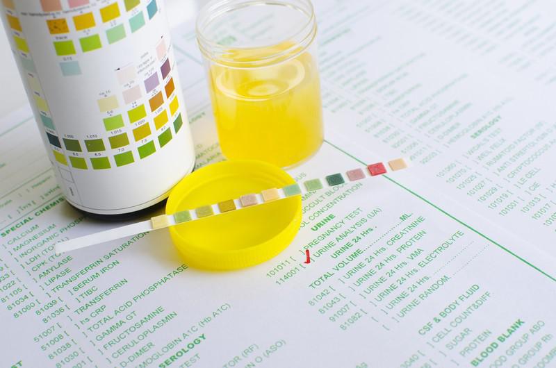 Examens et analyses