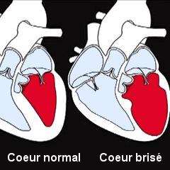 Syndrome du cœur brisé : ils meurent le même jour après 71 ans de mariage