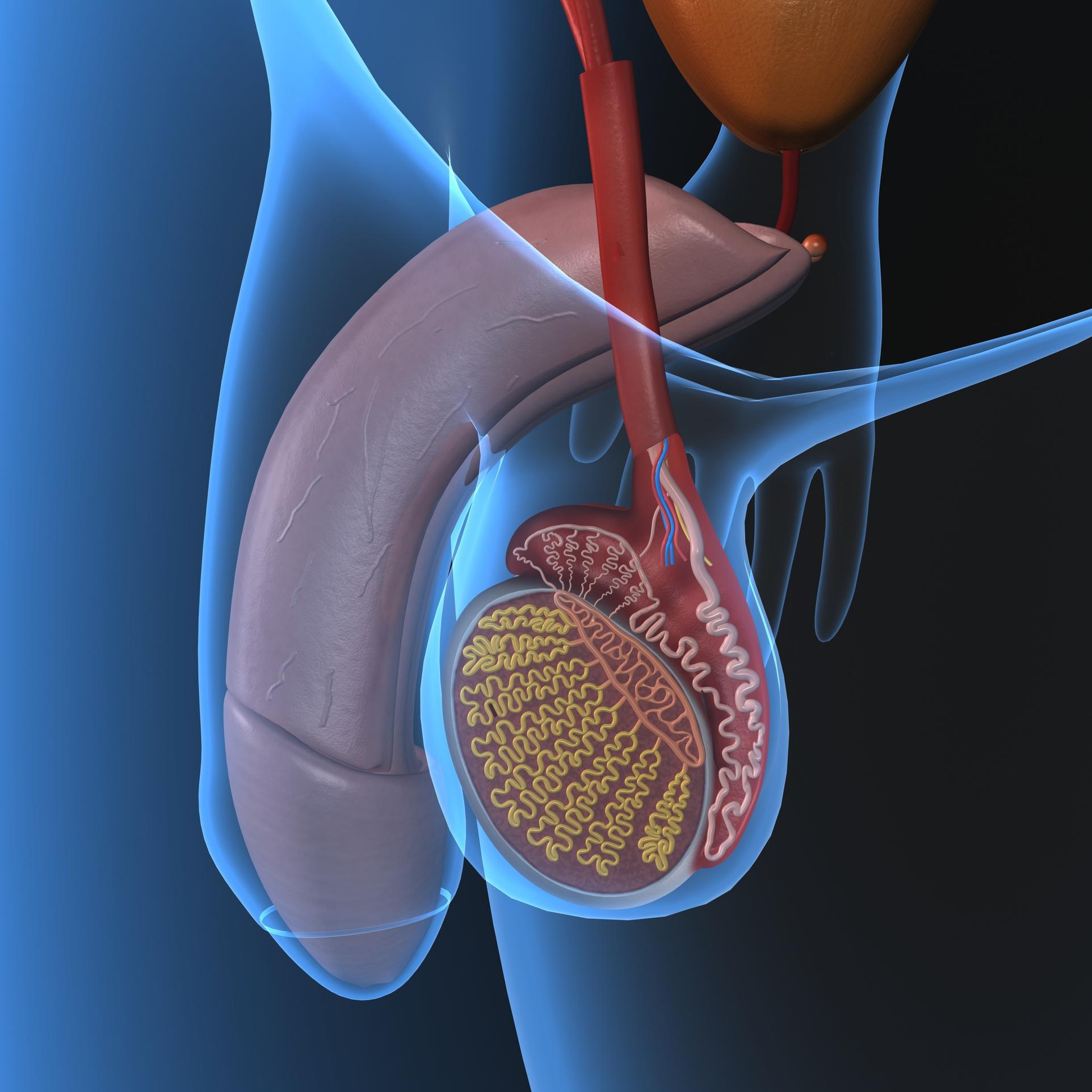 Adénome : quelle différence avec le cancer de la prostate ?