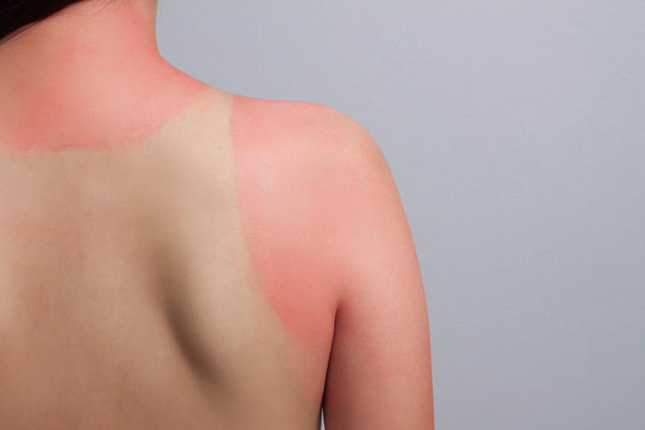 Quelles sont les causes de cette réaction cutanée ?