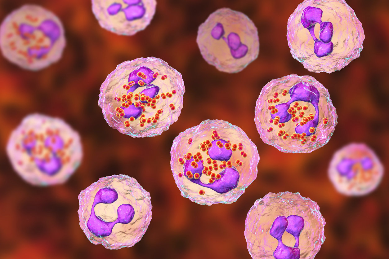 Purpura fulminans