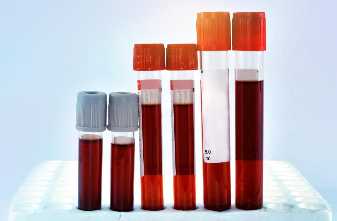 Examens et diagnostic de la bronchite asthmatiforme
