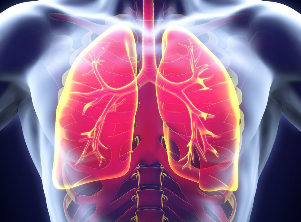Quelles sont les complications de la trachéite ?
