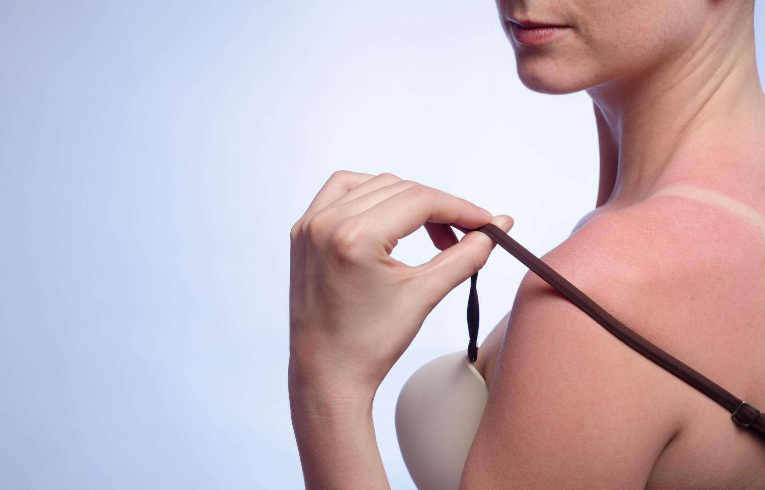 Des médicaments contre l'hypertension pourraient augmenter le risque de cancer de la peau