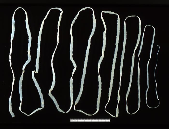 Le taenia saginata (ténia inerme) :