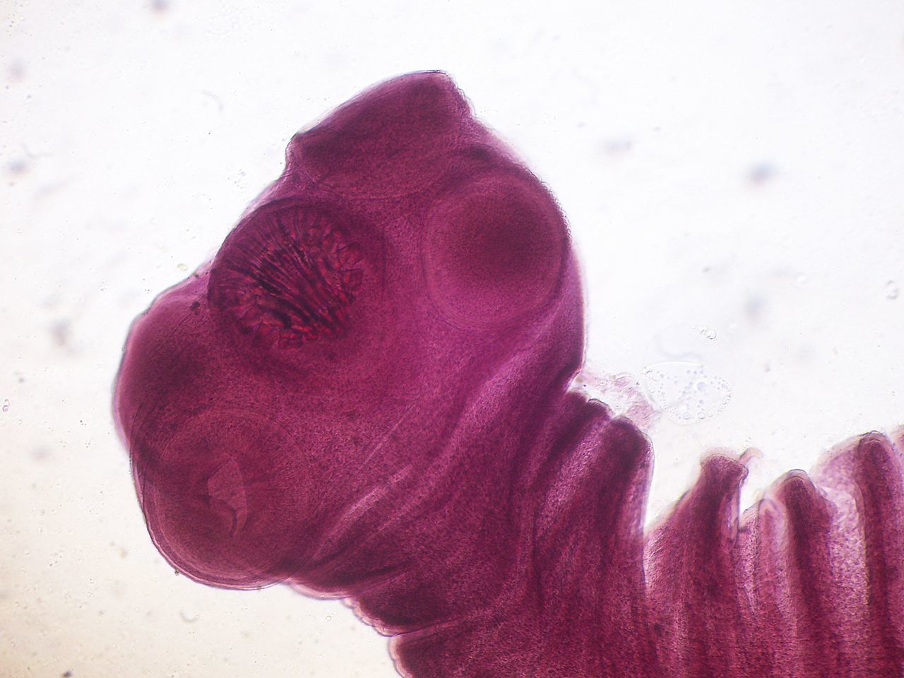 Le taenia solium (ténia armé) :