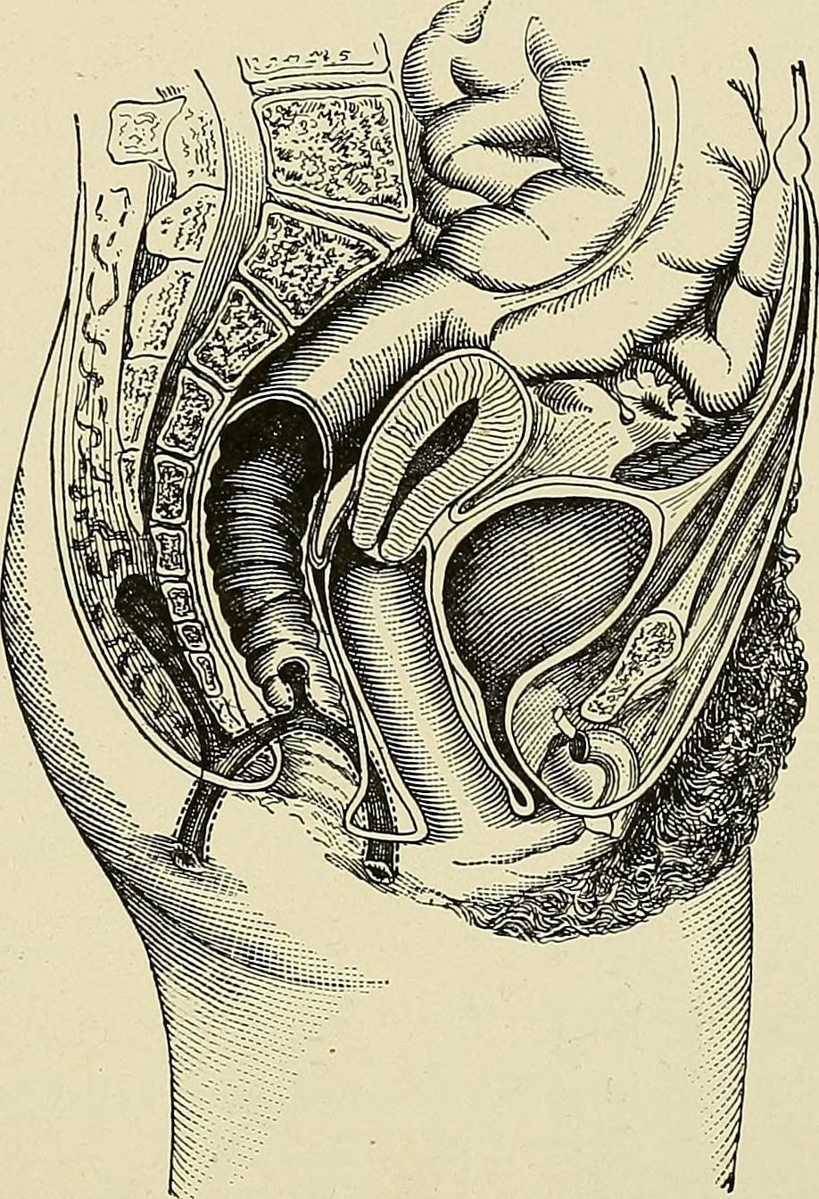 Les causes de la fistule anale