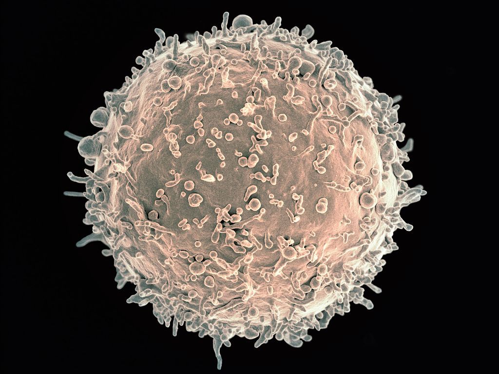 Pourquoi le lymphome de Burkitt est-il considéré comme un cancer pédiatrique ? 