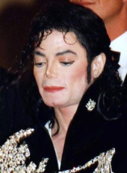 Chiffres : quelle est la prévalence du vitiligo ?