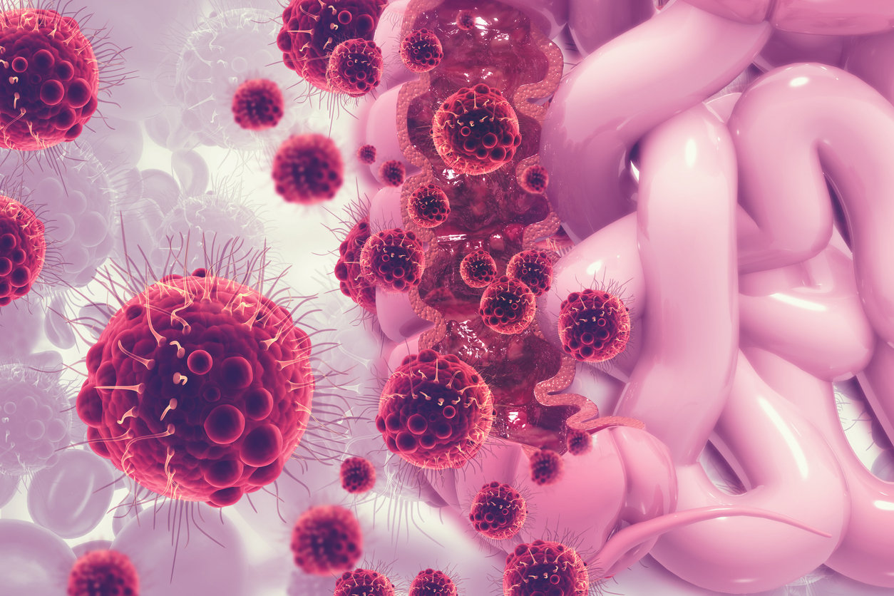 Quels sont les facteurs de risque de cancer du péritoine ?