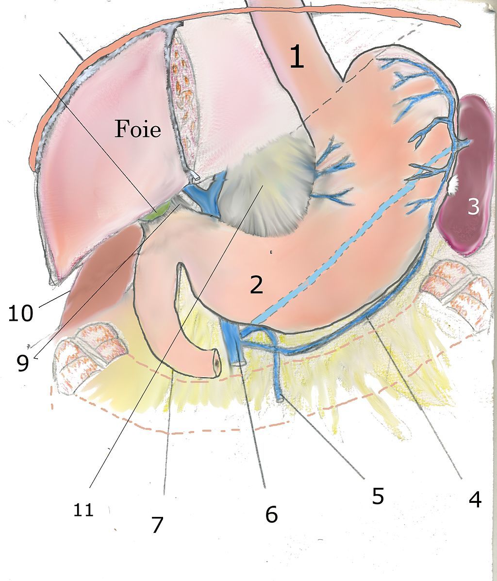 Qu'est-ce que le cancer de l'estomac ?
