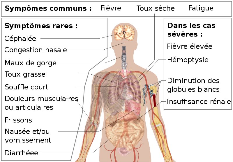 Symptômes du Covid-19 : quand apparaissent-ils ? 