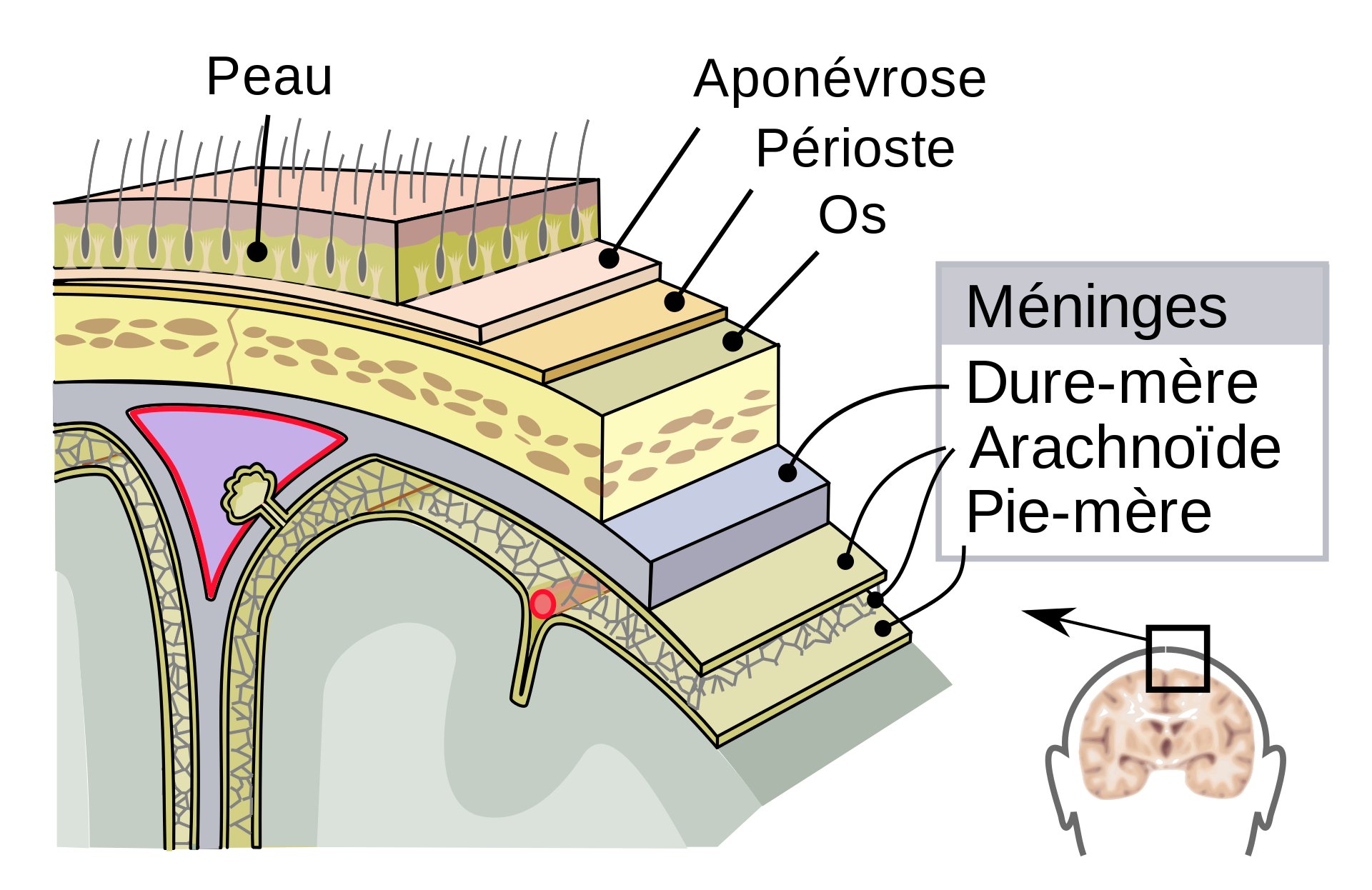 Causes : qu'est-ce qui déclenche une migraine ophtalmique ?