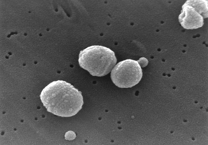 L'otite moyenne aiguë est généralement une surinfection bactérienne de l'oreille moyenne chez l’adulte