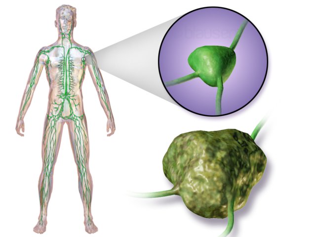 Lymphome : Zoom sur le système lymphatique