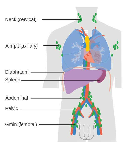 Définition : qu’est-ce qu’un lymphome ?