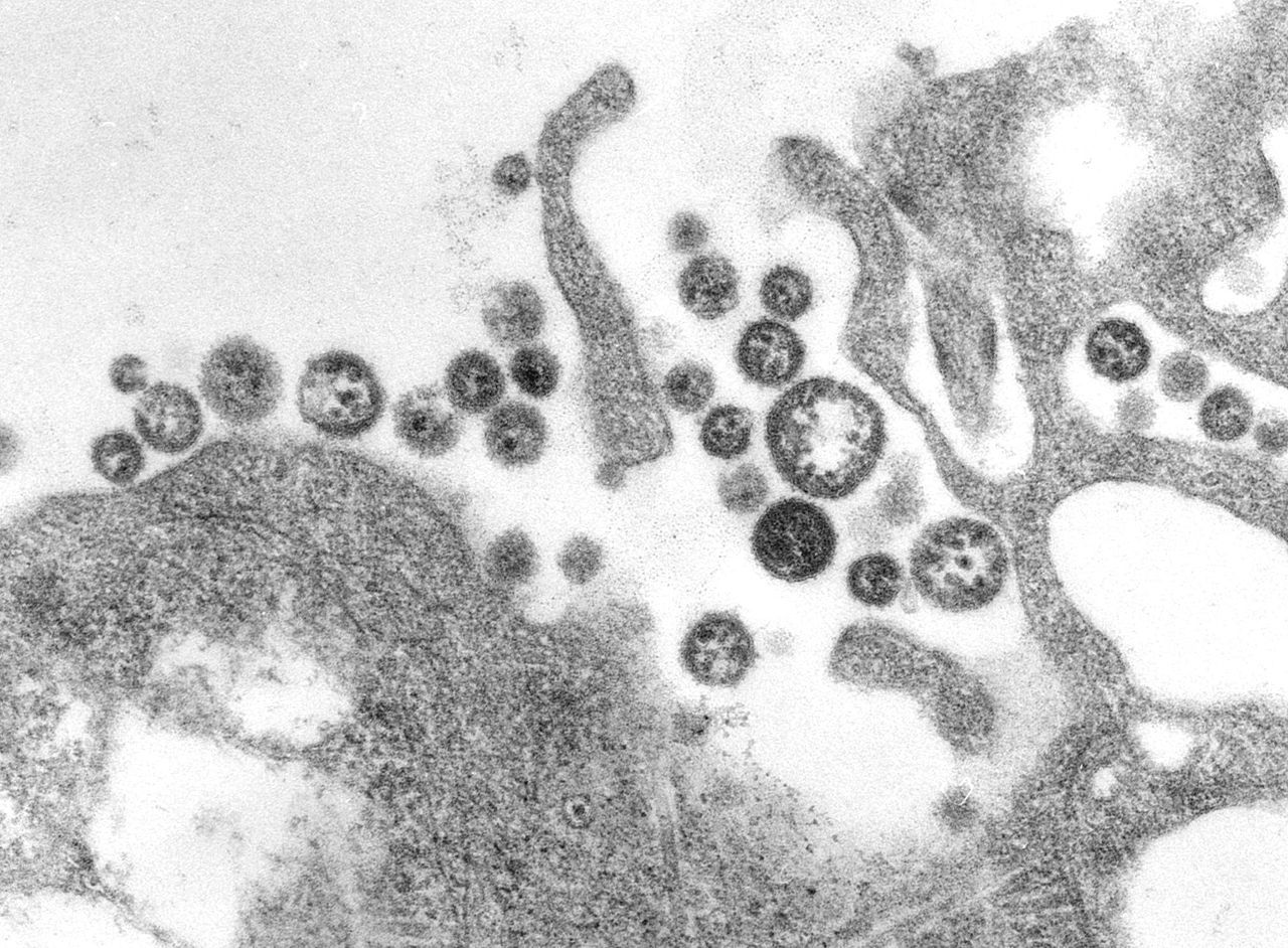 Fièvre de Lassa : combien de temps dure la maladie ?