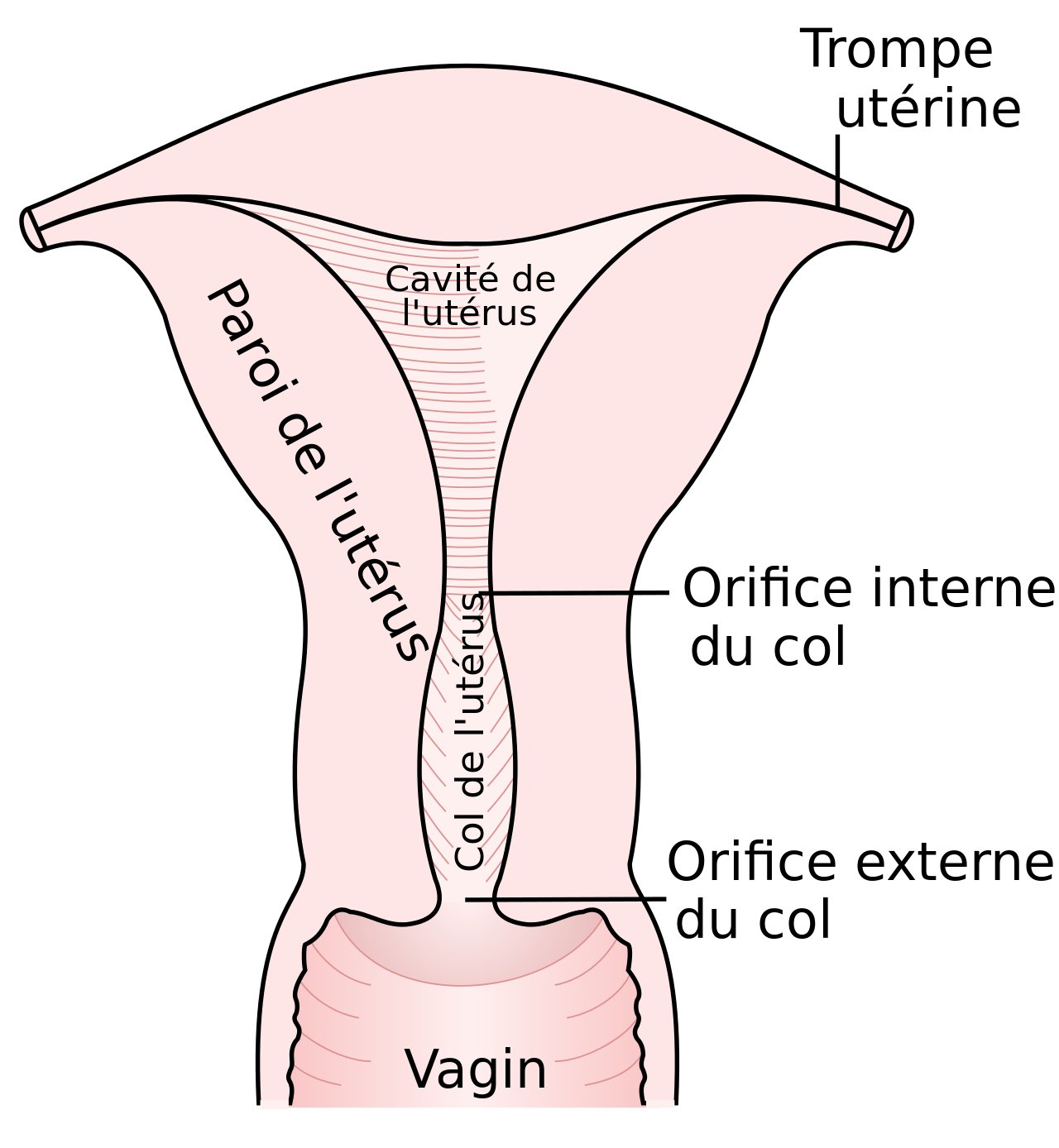 D'où viennent les vaginites ?