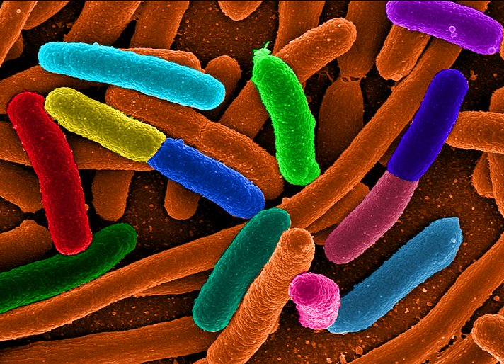Définition : qu'est-ce que l'infection urinaire ? 