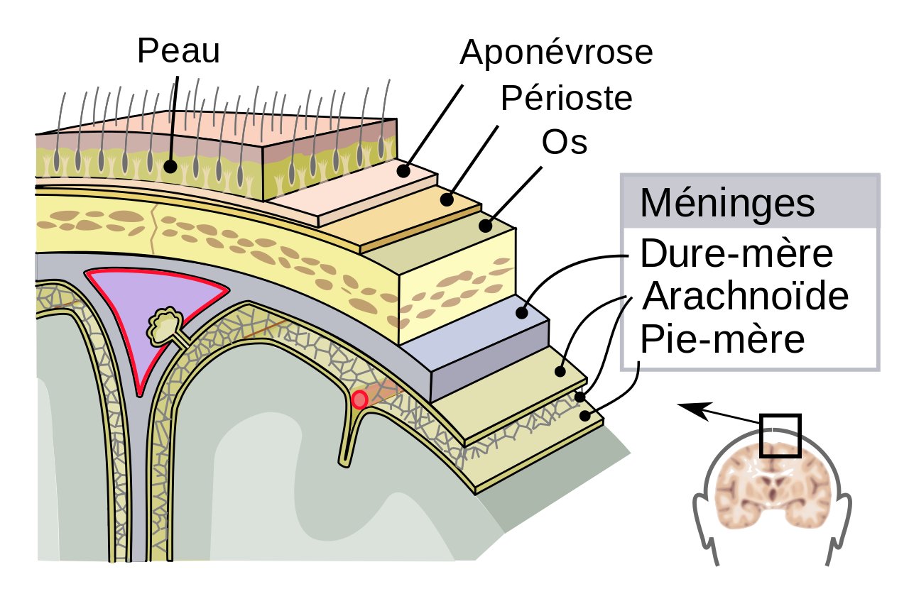Définition : qu’est-ce que le syndrome méningé ?