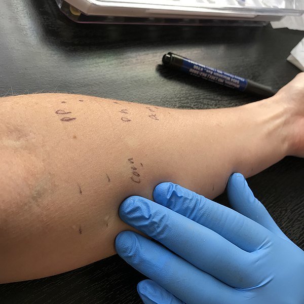 Diagnostic : quels examens et analyses faut-il faire ?