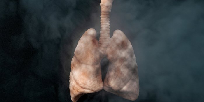 Cancer : le nombre des cas va augmenter de 60% d'ici 20 ans !