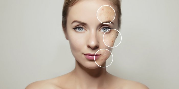 5 astuces pour une belle peau après 40 ans !
