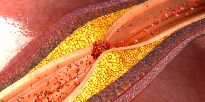 Coronavirus : les traitements à ne surtout pas arrêter !