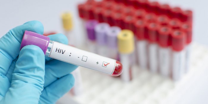 Covid-19 : les 7 maladies chroniques qui vous rendent le plus Ã  risques ! 