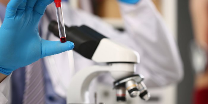 Coronavirus : la chimioprophylaxie, qu'est-ce que c'est ?
