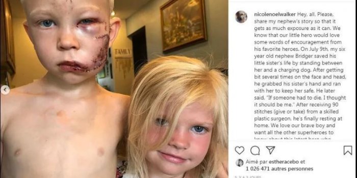 HÃ©ros Ã  6 ans : dÃ©figurÃ© par un chien pour sauver sa sÅur