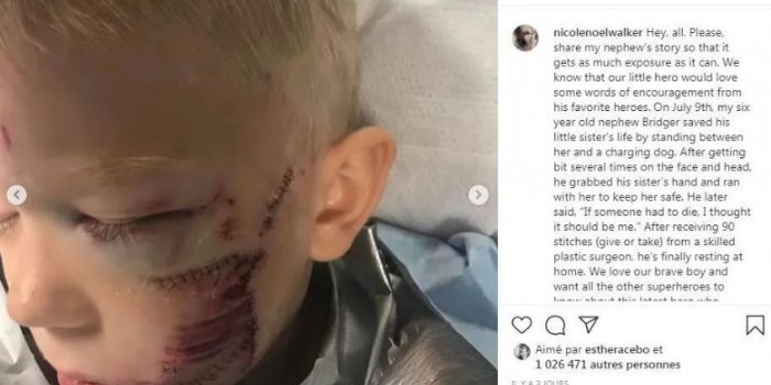 HÃ©ros Ã  6 ans : dÃ©figurÃ© par un chien pour sauver sa sÅur