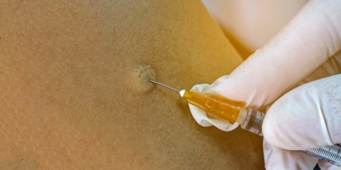 Vaccin contre le coronavirus : il aura bel et bien des effets secondaires
