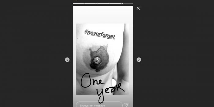 Alice Detollenaere, la compagne de Camille Lacourt, dévoile une photo de sa poitrine après son cancer du sein