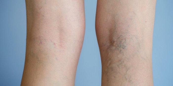 Dormir assis : les graves maladies que vous risquez