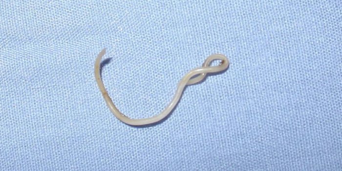 7 maladies qui ont les mêmes symptômes que la Covid-19