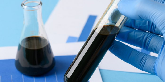 Urine : les couleurs qui doivent vous alerter