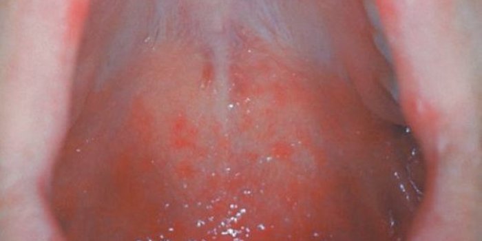 Covid-19 : 8 symptômes qui se cachent dans votre bouche
