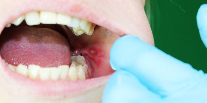 Covid-19 : 8 symptômes qui se cachent dans votre bouche