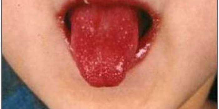 Covid-19 : 8 symptômes qui se cachent dans votre bouche