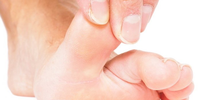 Maladies : 10 signes rÃ©vÃ©lateurs sur vos pieds 