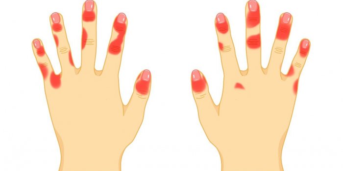 Covid-19 : 7 signes d'une immunitÃ© Ã©quilibrÃ©e selon un infectiologue