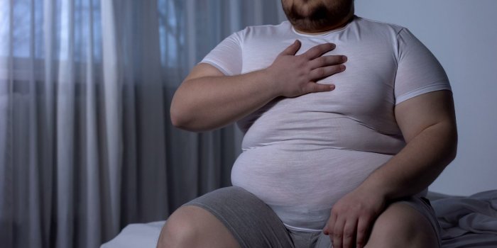 Les personnes en situation d'obÃ©sitÃ©