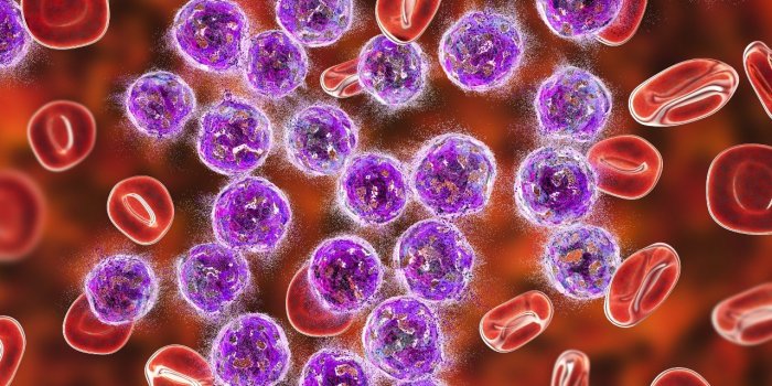 Vous Ãªtes touchÃ© par un cancer du sang : -39% d'efficacitÃ© vaccinale