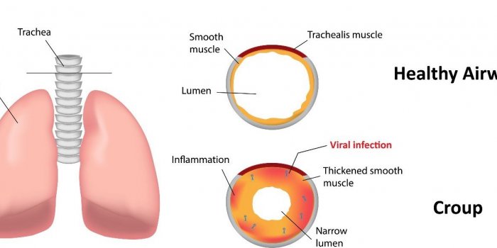Covid-19 : les symptômes du variant Omicron à surveiller