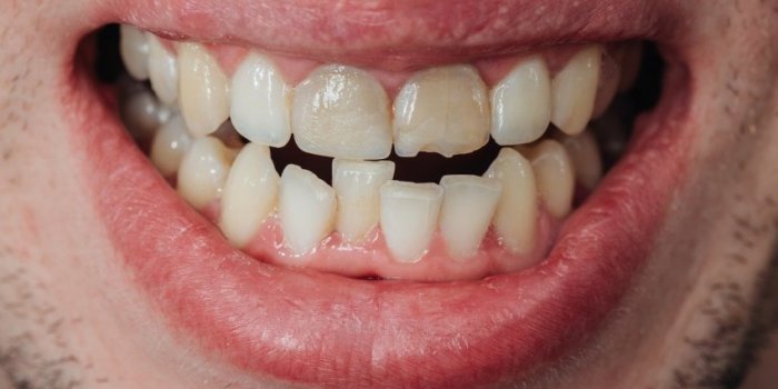 Terre, dent, insecte, sable⦠Toutes ces choses quâon mange sans le savoir