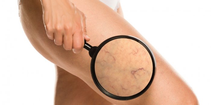 Cancer du pancréas : ces 5 sensations dans les jambes peuvent être un signe