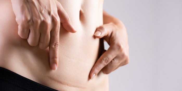 CÃ©sarienne, pÃ©ridurale, Ã©pisiotomieâ¦ 5 vÃ©ritÃ©s sur l'accouchement 