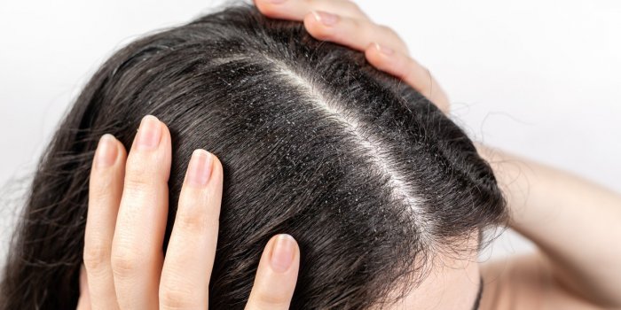 Hiver : 5 signes qui montrent que votre peau souffre du froid